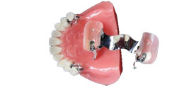 Partial Dentures Perth, WA Karratha, Port Hedland, Osborne Park